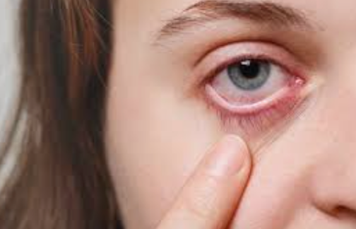 How Perimenopause Affects Your Eyes: Dryness, Blurry Vision, and Eye Health Risks Explained
