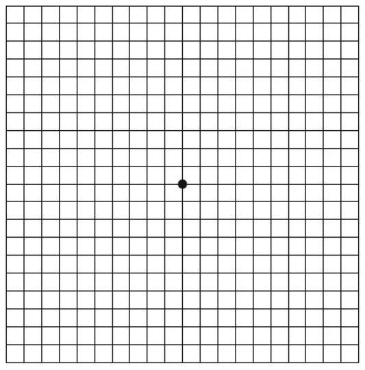 Macular Degeneration - Amsler Grid: Free Download